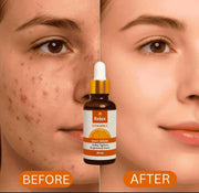 Relax Vitamin C Daily Serum